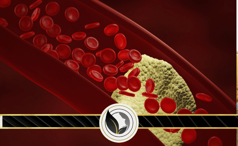 كيف تحمي نفسك من تصلب الشرايين
