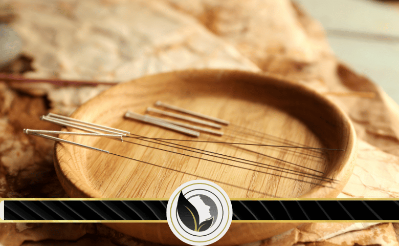 ريجيم الإبر الصينية