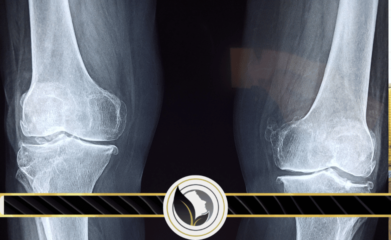 ماذا تعني عملية التعظم