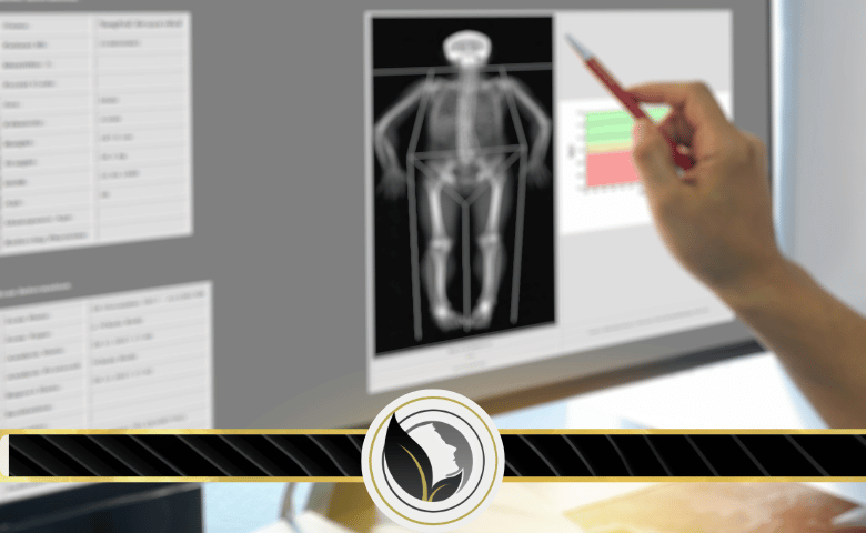 نصائح للوقاية من هشاشة العظام بعد انقطاع الطمث